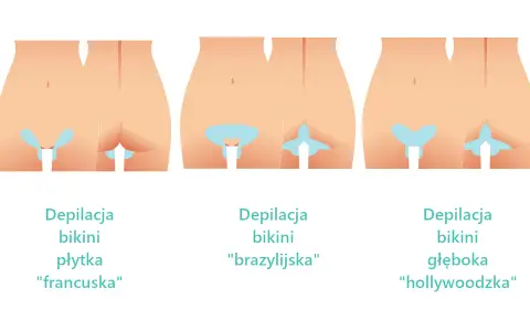 Depilacja bikini głębokiego: Co obejmuje? Różnice i efekty