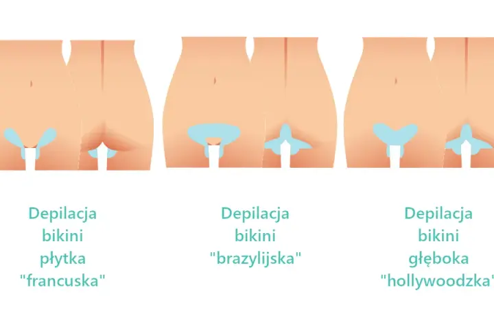 Depilacja bikini głębokiego: Co obejmuje? Różnice i efekty