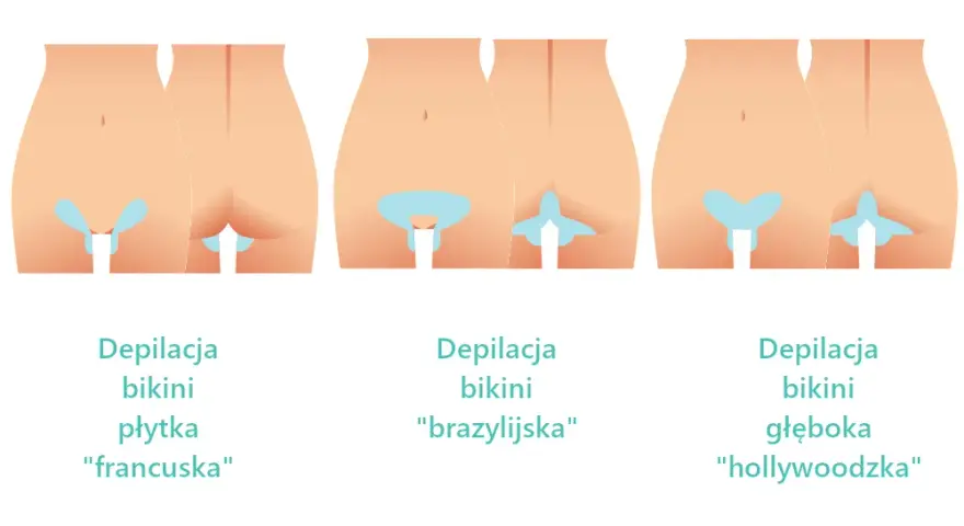 Depilacja bikini głębokiego: Co obejmuje? Różnice i efekty